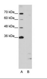 A: Marker, B: Jurkat Cell Lysate