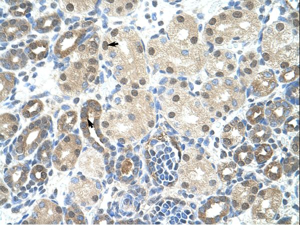 PPIE / Cyclophilin E antibody LS-C31549 was used in IHC to stain formalin-fixed, paraffin-embedded human kidney.