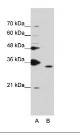 A: Marker, B: K562 Cell Lysate