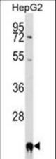 PPIF Antibody western blot of HepG2 cell line lysates (35 ug/lane). The PPIF antibody detected the PPIF protein (arrow).