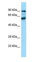 PPIG / Cyclophilin G antibody Western Blot of Jurkat.