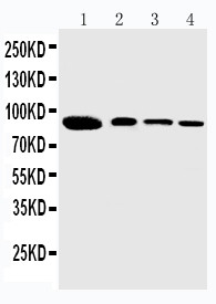 WB of PPIG / Cyclophilin G antibody. Lane 1: Rat Brain Tissue Lysate. Lane 2: HELA Cell Lysate. Lane 3: JURKAT Cell Lysate. Lane 4: PANC Cell Lysate.