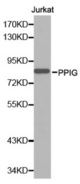 Western blot analysis of extracts of Jurkat cell line, using PPIG antibody.