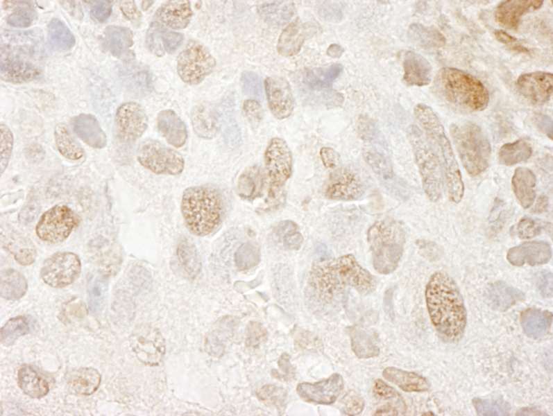 Detection of Mouse SRcyp Immunohistochemistry. Sample: FFPE section of mouse renal cell carcinoma. Antibody: Affinity purified rabbit anti-SRcyp used at a dilution of 1:250.
