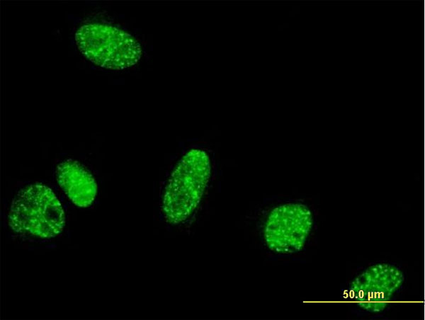 Immunofluorescence of monoclonal antibody to PPIG on HeLa cell. [antibody concentration 10 ug/ml].