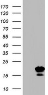 HEK293T cells were transfected with the pCMV6-ENTRY control (Left lane) or pCMV6-ENTRY PPIH (Right lane) cDNA for 48 hrs and lysed. Equivalent amounts of cell lysates (5 ug per lane) were separated by SDS-PAGE and immunoblotted with anti-PPIH.