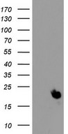 HEK293T cells were transfected with the pCMV6-ENTRY control (Left lane) or pCMV6-ENTRY PPIH (Right lane) cDNA for 48 hrs and lysed. Equivalent amounts of cell lysates (5 ug per lane) were separated by SDS-PAGE and immunoblotted with anti-PPIH.