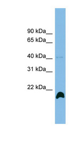 PPIH antibody LS-C116453 Western blot of THP-1 cell lysate.