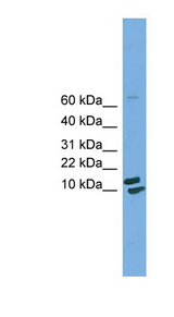 PPIH antibody LS-C116454 Western blot of HepG2 cell lysate.