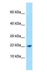 PPIL1 antibody Western Blot of A549.