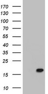 HEK293T cells were transfected with the pCMV6-ENTRY control (Left lane) or pCMV6-ENTRY PPIL1 (Right lane) cDNA for 48 hrs and lysed. Equivalent amounts of cell lysates (5 ug per lane) were separated by SDS-PAGE and immunoblotted with anti-PPIL1.