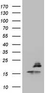 HEK293T cells were transfected with the pCMV6-ENTRY control (Left lane) or pCMV6-ENTRY PPIL1 (Right lane) cDNA for 48 hrs and lysed. Equivalent amounts of cell lysates (5 ug per lane) were separated by SDS-PAGE and immunoblotted with anti-PPIL1.