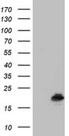 HEK293T cells were transfected with the pCMV6-ENTRY control (Left lane) or pCMV6-ENTRY PPIL1 (Right lane) cDNA for 48 hrs and lysed. Equivalent amounts of cell lysates (5 ug per lane) were separated by SDS-PAGE and immunoblotted with anti-PPIL1.