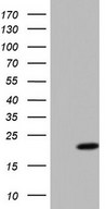 HEK293T cells were transfected with the pCMV6-ENTRY control (Left lane) or pCMV6-ENTRY PPIL1 (Right lane) cDNA for 48 hrs and lysed. Equivalent amounts of cell lysates (5 ug per lane) were separated by SDS-PAGE and immunoblotted with anti-PPIL1.
