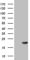 HEK293T cells were transfected with the pCMV6-ENTRY control (Left lane) or pCMV6-ENTRY PPIL1 (Right lane) cDNA for 48 hrs and lysed. Equivalent amounts of cell lysates (5 ug per lane) were separated by SDS-PAGE and immunoblotted with anti-PPIL1.