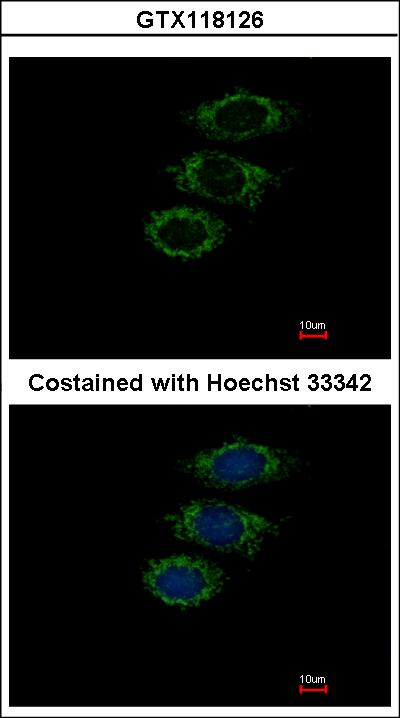 Immunofluorescence of paraformaldehyde-fixed MCF-7, using PPIL1 antibody at 1:500 dilution.