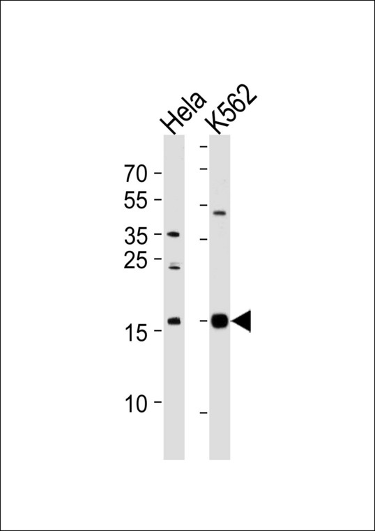 Western blot of lysates from HeLa, K562 cell line (from left to right), using PPIL1 Antibody. Antibody was diluted at 1:1000 at each lane. A goat anti-rabbit IgG H&L (HRP) at 1:5000 dilution was used as the secondary antibody. Lysates at 35ug per lane.