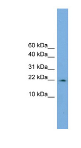 PPIL3 antibody LS-C116413 Western blot of COLO205 cell lysate.