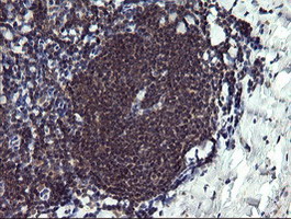 IHC of paraffin-embedded Human tonsil using anti-PPIL3 mouse monoclonal antibody.