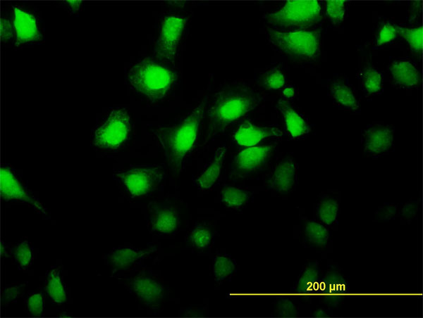 Immunofluorescence of monoclonal antibody to MKNK2 on HeLa cell. [antibody concentration 25 ug/ml]