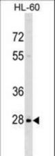 PPIL6 Antibody western blot of HL-60 cell line lysates (35 ug/lane). The PPIL6 antibody detected the PPIL6 protein (arrow).
