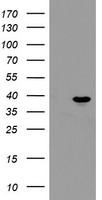 HEK293T cells were transfected with the pCMV6-ENTRY control (Left lane) or pCMV6-ENTRY PPIL6 (Right lane) cDNA for 48 hrs and lysed. Equivalent amounts of cell lysates (5 ug per lane) were separated by SDS-PAGE and immunoblotted with anti-PPIL6.
