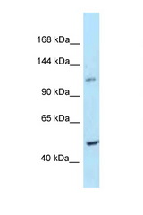 PPIP5K2 / HISPPD1 antibody LS-C146105 Western blot of Mouse Thymus lysate. Antibody concentration 1 ug/ml.