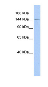 PPIP5K2 / HISPPD1 antibody LS-C102598 Western blot of Transfected 293T cell lysate.