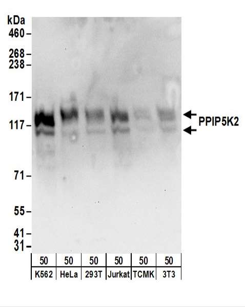 Detection of Human and Mouse PPIP5K2 by Western Blot. Samples: Whole cell lysate (50 ug) from K562, HeLa, 293T, Jurkat, mouse TCMK-1, and mouse NIH3T3 cells. Antibodies: Affinity purified rabbit anti-PPIP5K2 antibody used for WB at 0.4 ug/ml. Detection: Chemiluminescence with an exposure time of 10 seconds.