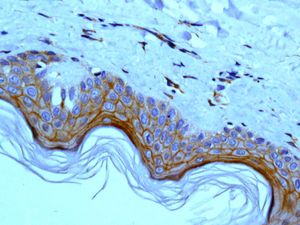IHC of paraffin-embedded human skin tissue using anti-PPL / Periplakin antibody.