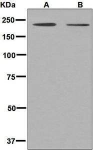 Western blot analysis on (A) HACAT and (B) human skin lysates using anti-PPL / Periplakin antibody.