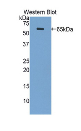 Western blot of recombinant PPL / Periplakin.