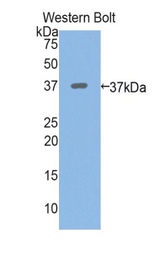 Western blot of recombinant PPL / Periplakin.