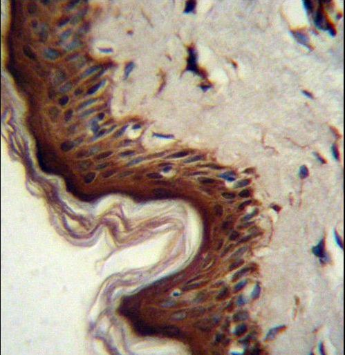 PPL Antibody immunohistochemistry of formalin-fixed and paraffin-embedded human skin tissue followed by peroxidase-conjugated secondary antibody and DAB staining.