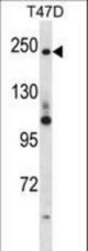 PPL Antibody western blot of T47D cell line lysates (35 ug/lane). The PPL antibody detected the PPL protein (arrow).
