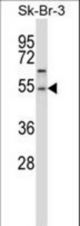 PPM1A Antibody (pS) western blot of SK-BR-3 cell line lysates (35 ug/lane). The PPM1A antibody detected the PPM1A protein (arrow).
