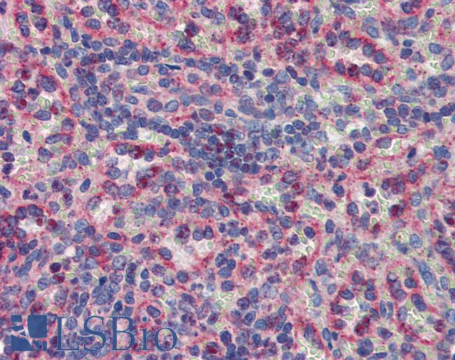 Anti-MKNK2 / MNK2 antibody IHC of human spleen. Immunohistochemistry of formalin-fixed, paraffin-embedded tissue after heat-induced antigen retrieval. Antibody LS-B3999 concentration 5 ug/ml.