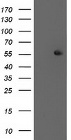 HEK293T cells were transfected with the pCMV6-ENTRY control (Left lane) or pCMV6-ENTRY PPM1B (Right lane) cDNA for 48 hrs and lysed. Equivalent amounts of cell lysates (5 ug per lane) were separated by SDS-PAGE and immunoblotted with anti-PPM1B.