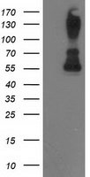 HEK293T cells were transfected with the pCMV6-ENTRY control (Left lane) or pCMV6-ENTRY PPM1B (Right lane) cDNA for 48 hrs and lysed. Equivalent amounts of cell lysates (5 ug per lane) were separated by SDS-PAGE and immunoblotted with anti-PPM1B.