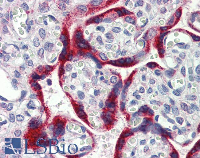 Anti-MKNK2 / MNK2 antibody IHC of human placenta. Immunohistochemistry of formalin-fixed, paraffin-embedded tissue after heat-induced antigen retrieval. Antibody LS-B3999 concentration 5 ug/ml.