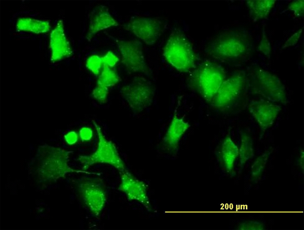 Immunofluorescence of monoclonal antibody to PPM1B on HeLa cell. [antibody concentration 10 ug/ml]