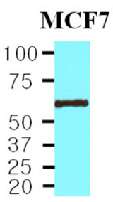 Cell lysates of MCF7 (30 ug) were resolved by SDS-PAGE, transferred to NC membrane and probed with anti-human PPM1B (1:2000). Proteins were visualized using a goat anti-mouse secondary antibody conjugated to HRP and an ECL detection system.