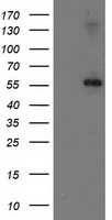 HEK293T cells were transfected with the pCMV6-ENTRY control (Left lane) or pCMV6-ENTRY PPM1B (Right lane) cDNA for 48 hrs and lysed. Equivalent amounts of cell lysates (5 ug per lane) were separated by SDS-PAGE and immunoblotted with anti-PPM1B.