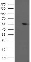 HEK293T cells were transfected with the pCMV6-ENTRY control (Left lane) or pCMV6-ENTRY PPM1B (Right lane) cDNA for 48 hrs and lysed. Equivalent amounts of cell lysates (5 ug per lane) were separated by SDS-PAGE and immunoblotted with anti-PPM1B.