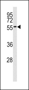 Western blot of MNK2 (MKNK2) antibody in 293 cell line lysates (35 ug/lane). MNK2 (arrow) was detected using the purified antibody.