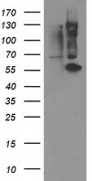 HEK293T cells were transfected with the pCMV6-ENTRY control (Left lane) or pCMV6-ENTRY PPM1B (Right lane) cDNA for 48 hrs and lysed. Equivalent amounts of cell lysates (5 ug per lane) were separated by SDS-PAGE and immunoblotted with anti-PPM1B.