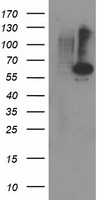 HEK293T cells were transfected with the pCMV6-ENTRY control (Left lane) or pCMV6-ENTRY PPM1B (Right lane) cDNA for 48 hrs and lysed. Equivalent amounts of cell lysates (5 ug per lane) were separated by SDS-PAGE and immunoblotted with anti-PPM1B.