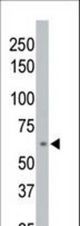 The anti-PPM1D antibody is used in Western blot to detect PPM1D in 293 cell lysate.