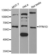 Western blot analysis of extracts of various cell lines, using PPM1D antibody.
