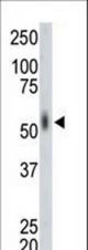 The anti-MKNK2 antibody is used in Western blot to detect MKNK2 in mouse lung tissue lysate.
